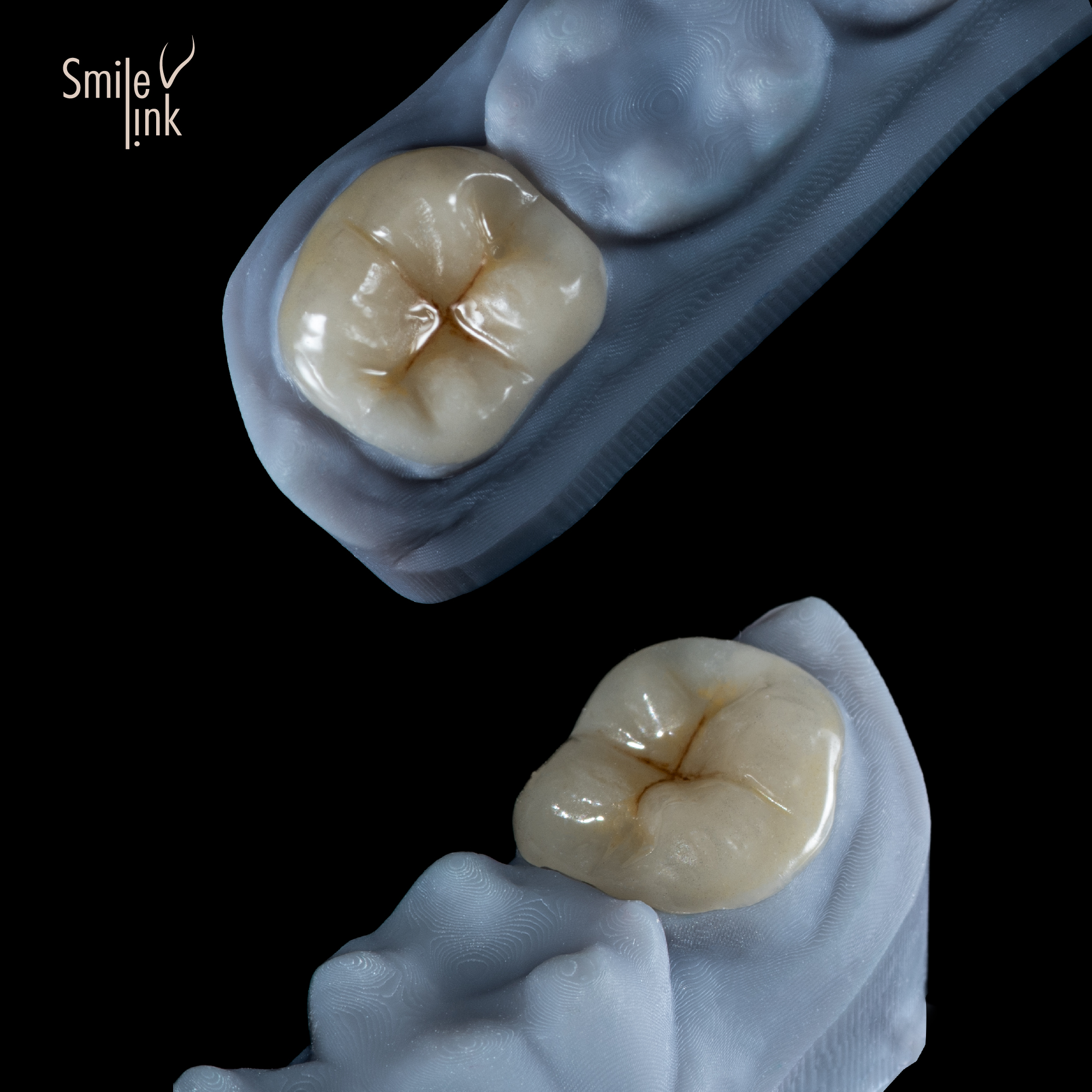 Precision-Crafted Restorations